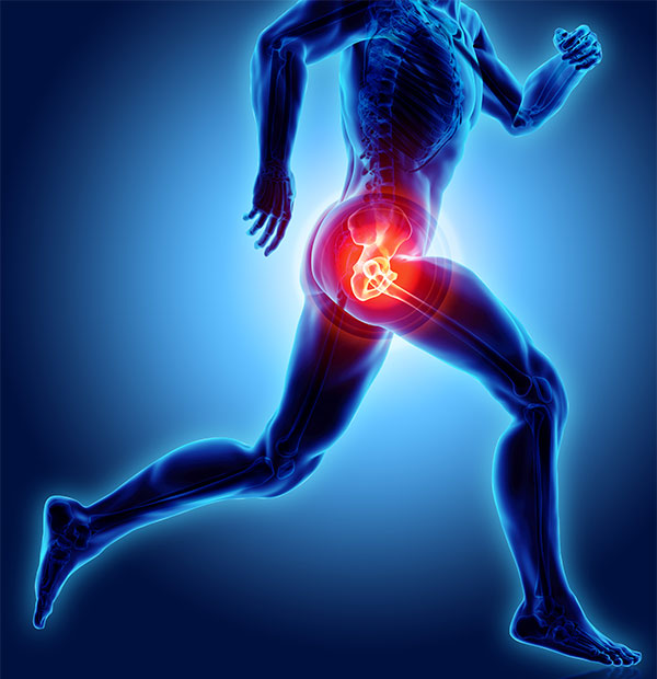 Platelet Rich Plasma (PRP) - 3 -Educational Picture